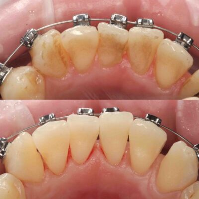 стоматология цены на лечение зубов