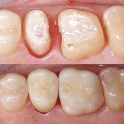 лечение зубов фрунзенская