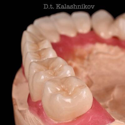 лечение и протезирование зубов в спб